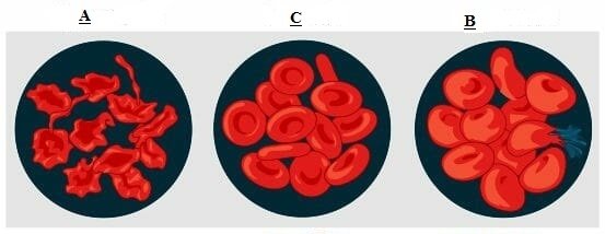 C:wampwwwafricaimagesOsmotic-pressure-on-blood-cells-diagram.jpg